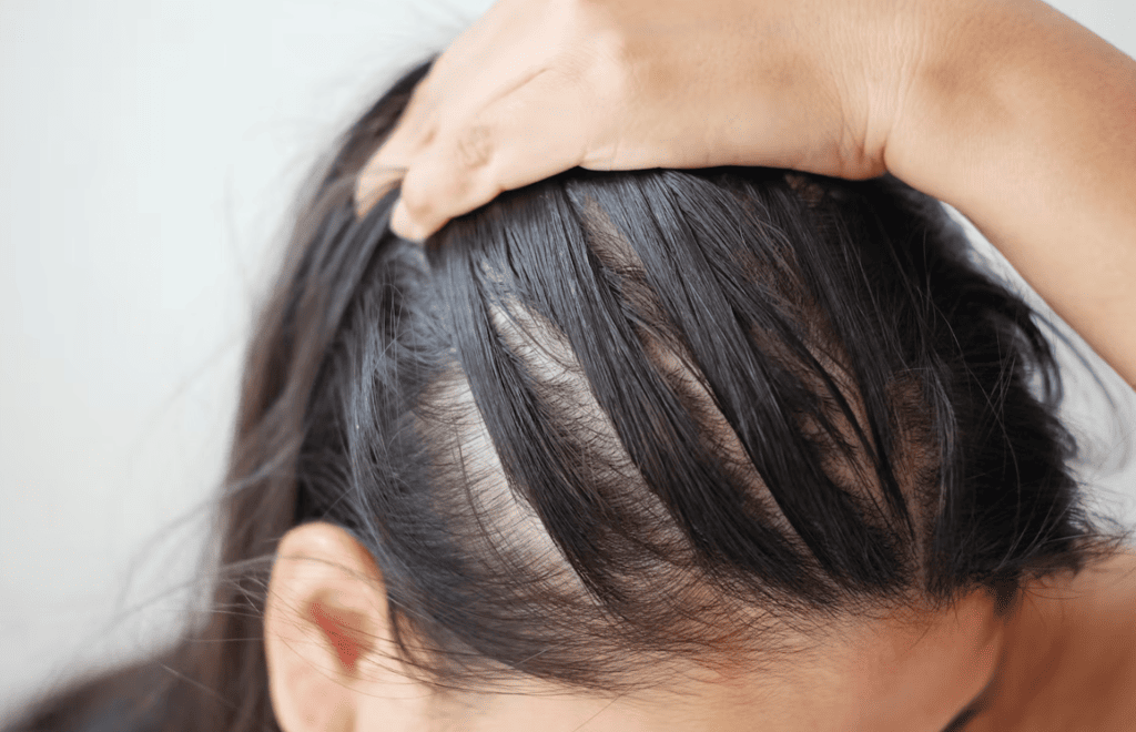 6 Dermatologist Approved Ways To Outsmart Thinning Hair